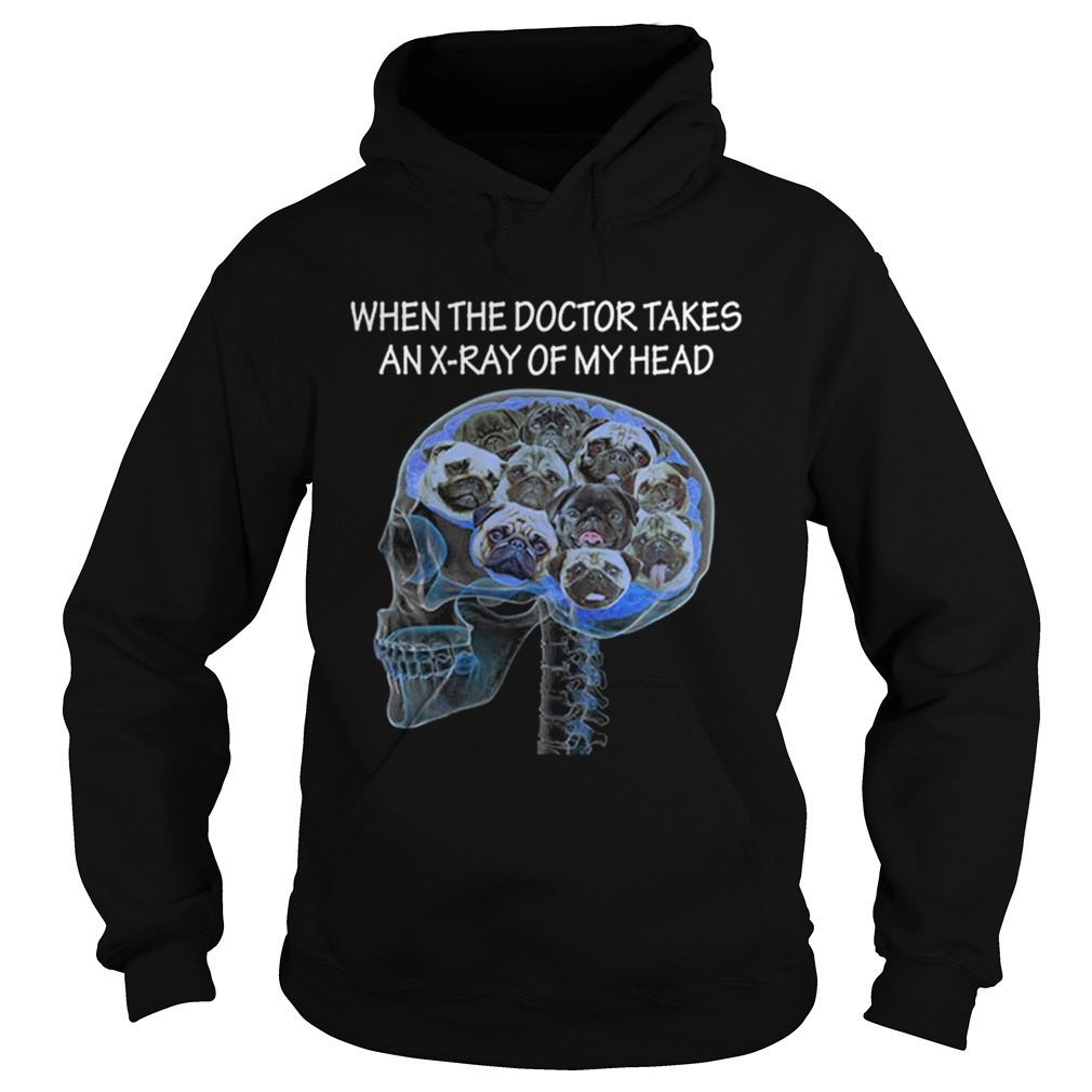 Skull pug When the doctor takes an xray of my head Hoodie